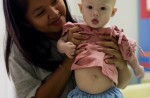 Abandoned baby Gammy left with Thai surrogate - 5