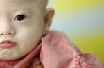 Abandoned baby Gammy left with Thai surrogate - 15