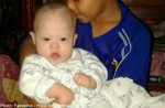 Abandoned baby Gammy left with Thai surrogate - 21