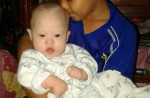 Abandoned baby Gammy left with Thai surrogate - 25