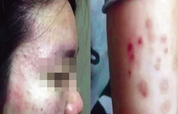 Fears grow about toxic environments in Chinese school