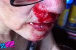 Caught on camera: Woman viciously beaten up by neighbour - 11