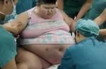 Rare disorder causes 143kg boy to eat incessantly - 5