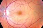Dick Lee's struggles with vision problems - 7