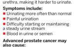 6 things to know about prostate cancer - 8