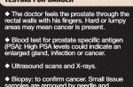 6 things to know about prostate cancer - 16