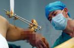 Unbelievable organ transplant stories - 35