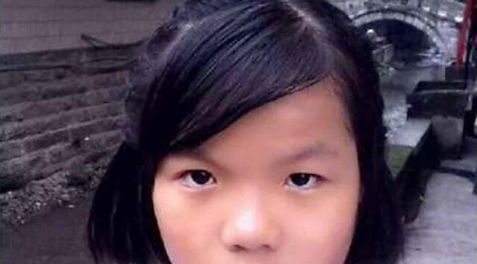 Teen suffers burns trying to save dad, may need to amputate both hands