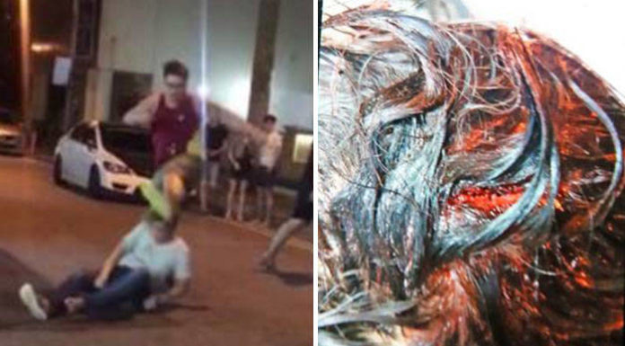 Man who got knocked out in Geylang attack: I just looked at them and they started attacking me