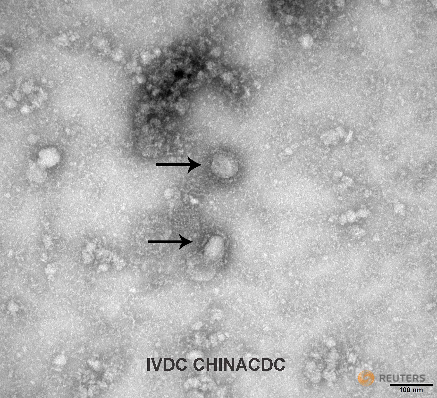 A Transmission Electron Microscopy image of the first isolated case of the Wuhan coronavirus